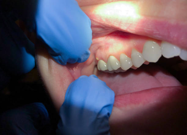 Best After-Hours Dental Trauma Care in Baden, MD